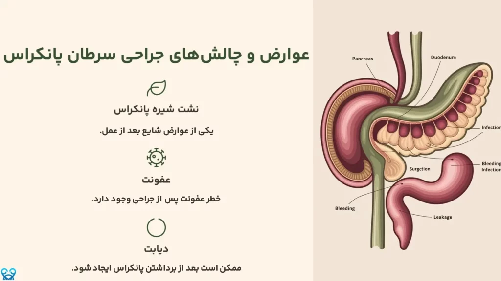 عوارض و چالش‌های جراحی سرطان پانکراس