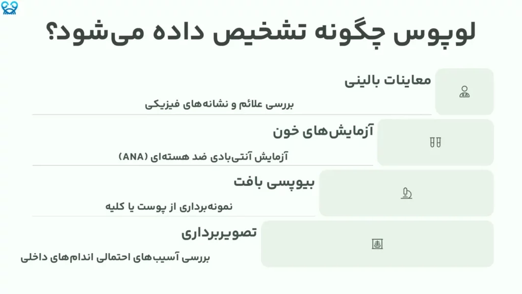لوپوس چگونه تشخیص داده میشود؟